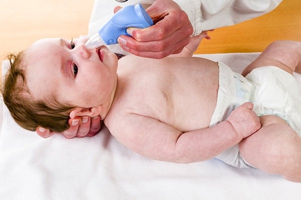 cách chữa ngạt mũi cho trẻ sơ sinh